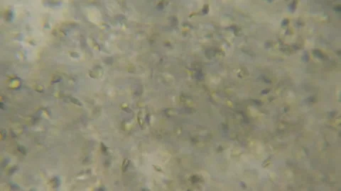Moving Human Sperm Under Phase Contrast Microscope. Sperm (Spermatozoa) Viewe Stock Footage 187548507