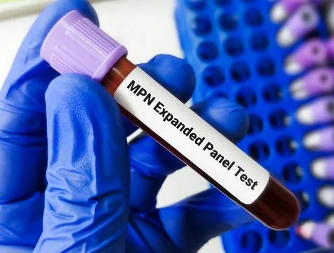 The MPN Expanded panel PCR test Foto stock
