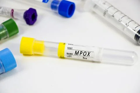 Mpox blood test empty tubes samples on the white background, studio shoot. Stock Photos