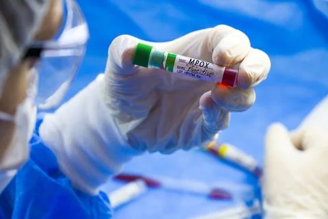 Mpox blood test empty tubes samples Stock Photos