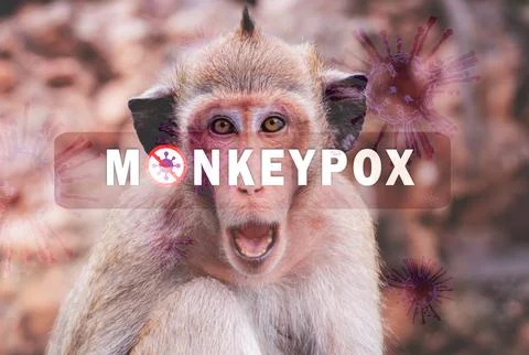 Mpox caused by monkeypox virus. Monkeypox outbreak. Viral transmission from.. 스톡 사진