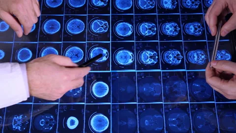 Mri Analysis  Video stock 194831642
