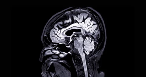 MRI of the brain. | Stock Video | Pond5