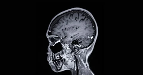 MRI of the brain Stock Footage 210228826