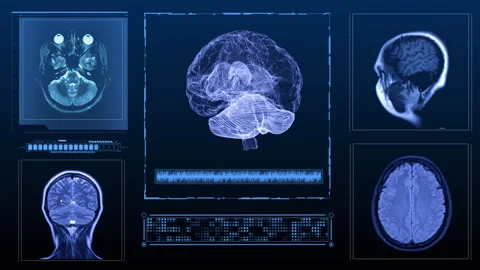 MRI of the brain Stock Footage 245917224