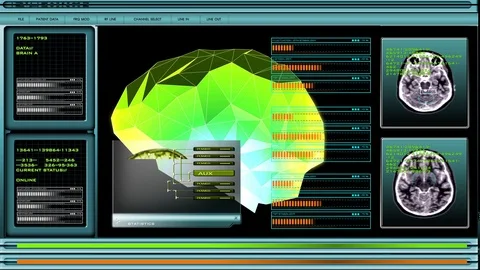 MRI Brain Scan 1 Stock Footage 94688767