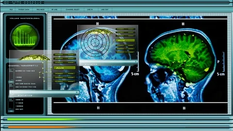 MRI Brain Scan 4 Stock Footage 94688774