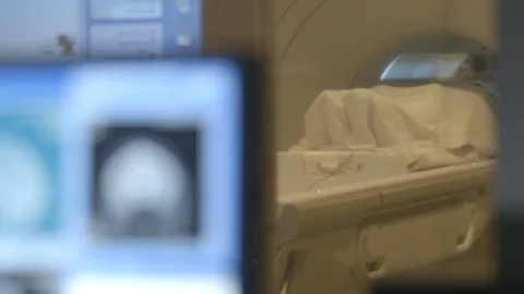 MRI Brain scan and machine - rack focus Stock Footage 128983175