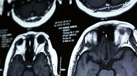 MRI brain scan, Dolly shot Stock Footage