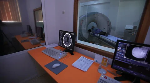 MRI brain scan Vídeos de archivo 36619927