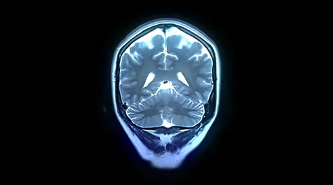 MRI brain scan Stock Footage