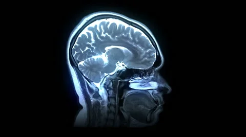 MRI brain scan Stock-Footage 63207419