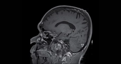 MRI Brain scan . Stock Footage 232109282