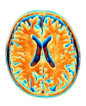 MRI Brain scan, heightmap 스톡 일러스트