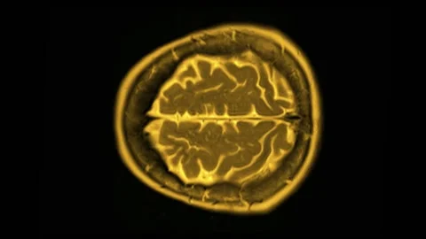 Mri Brain Scan. Human Brain Scan. Vídeo Stock 134964952