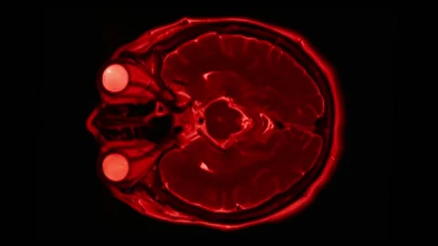 Mri Brain Scan. Human Brain Scan. | Stock Video | Pond5