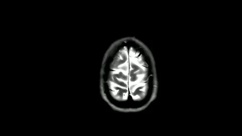 MRI brain scan magnetic resonance imaging top Neurology data analysis process Stock Footage 336561164