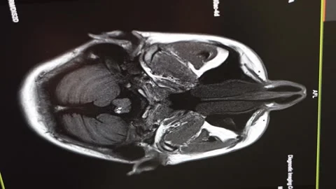 MRI brain scan. Medical, science and education mri brain. Magnetic resonance. Stock Footage 297247385