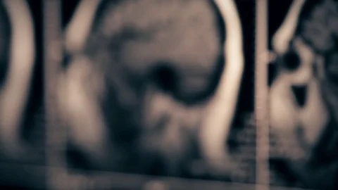 MRI brain scan or X-Ray imaging Stock Footage 83111848