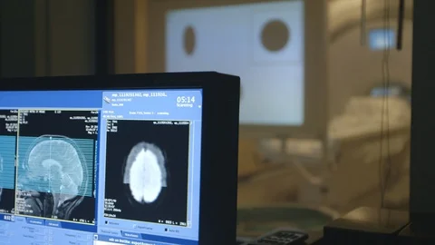 MRI Brain scan screen Stock Footage 128982318