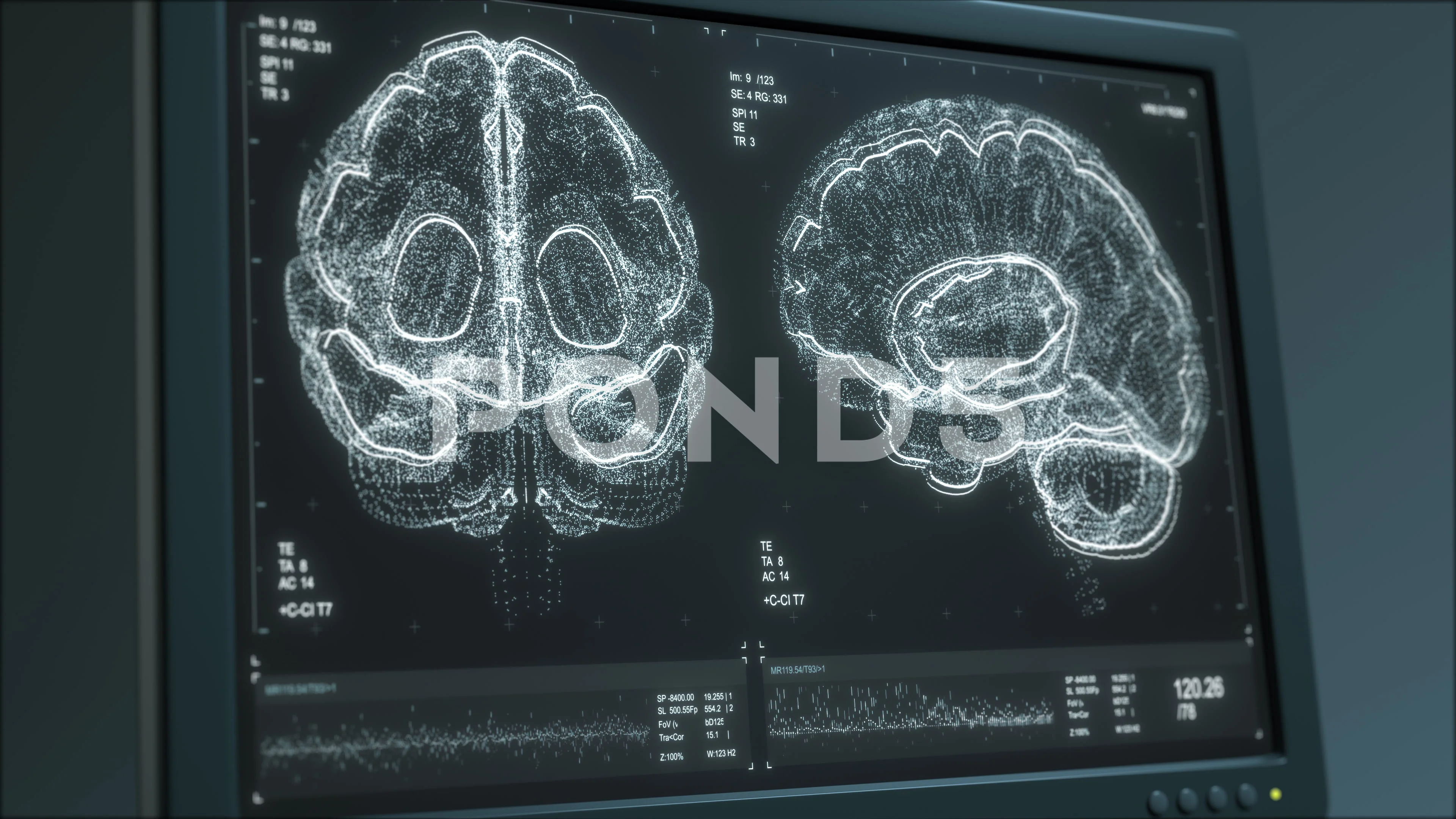 MRI brain scanning animation. Head diagn... | Stock Video | Pond5