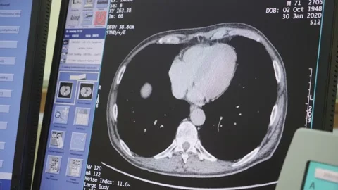 MRI computer diagnostics. Stock Footage 137216408