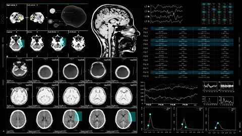 Mri Data Computer Interface  스톡 동영상 220558577