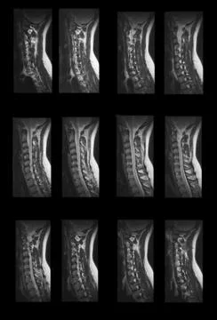 MRI Diagnostics Stock Photos