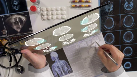 Mri Examination  Stock-Footage 138112671