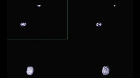 MRI FOOT Stock Footage 116335523