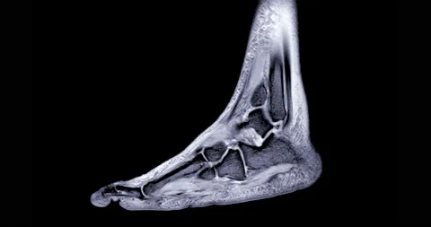 MRI foot scan. Stock Footage 222928213