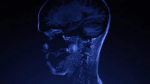MRI Stock Footage 43909950