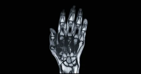 MRI hand . Stock Footage 160360183