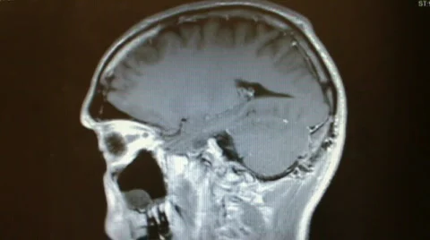 MRI of head brain Stock Footage