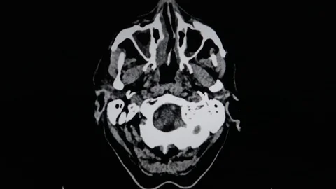 MRI of head / brain Stock-Footage 121707437