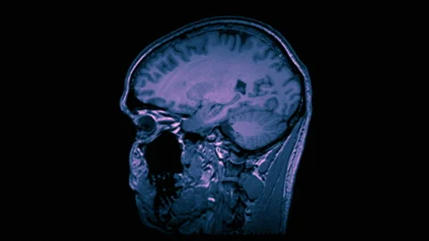 MRI head scan brain exam. MRI anatomy an... | Stock Video | Pond5