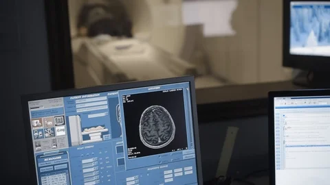 MRI head scan process. High tech Medical Screens with results of Brain scanning Stock Footage 102224110