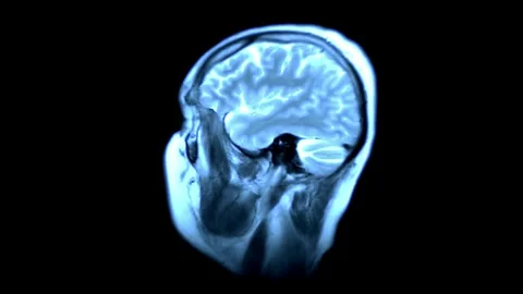 Mri human brain scan concept of hospital health science laboratory medicine Stock Footage 336561080