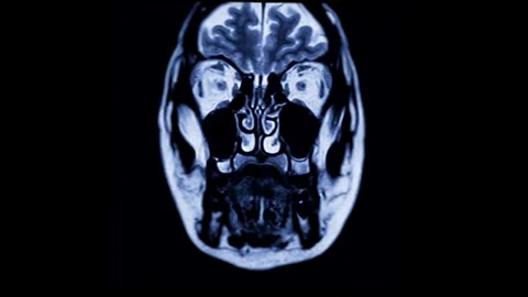 Mri human brain scan concept of hospital health science laboratory medicine Stock Footage 336561143