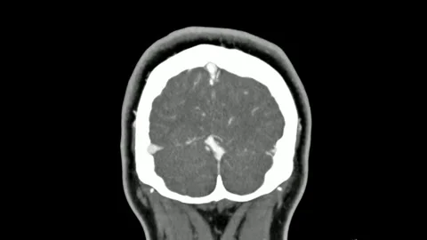Mri human brain scan concept of hospital health science laboratory medicine 스톡 동영상 336569289