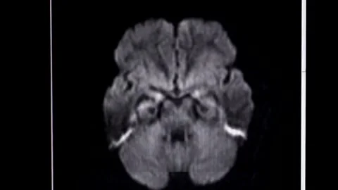 Mri human brain scan concept of hospital health science laboratory medicine Stockbeeldmateriaal 336569342
