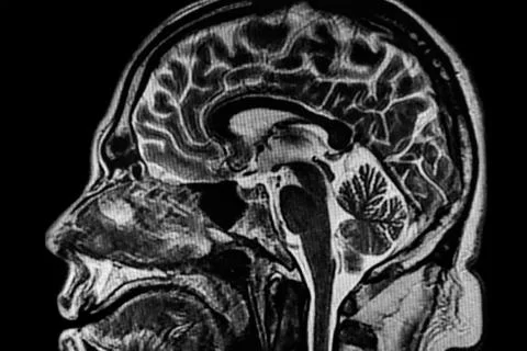 MRI image brain 스톡 사진