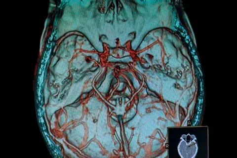 MRI image brain Stock Photos