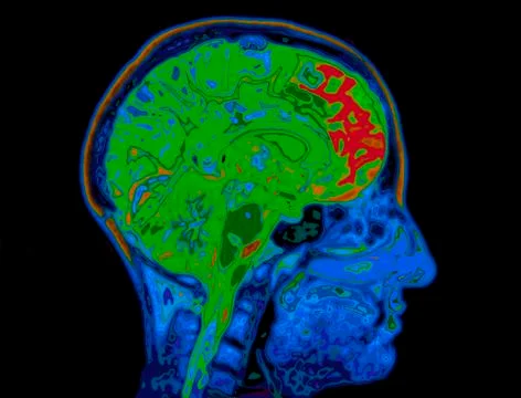 Mri image of head showing brain Stock Illustration