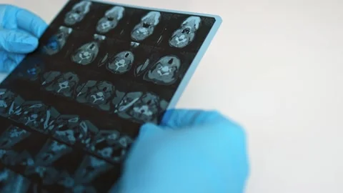 MRI image of the thyroid gland. Stock Footage 289328891