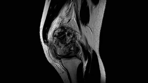MRI Knee10092564-0 Stock Footage 158902322