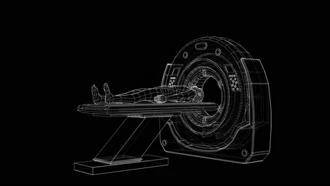 MRI machine scanning patient inside. Seamless video Stock Footage 146685479