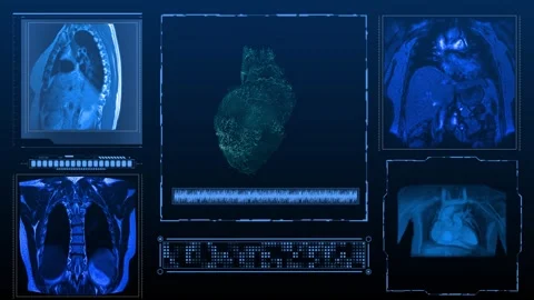 MRI multi heart Stock Footage 246311383