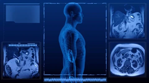 MRI multi human urinary system Stock Footage 271187034