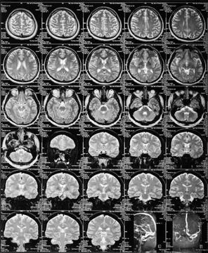 Mri Foto stock